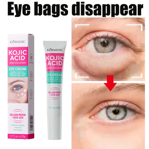 Collagen Eye Cream Remove Eyes Bags Anti Dark Circles Puffiness