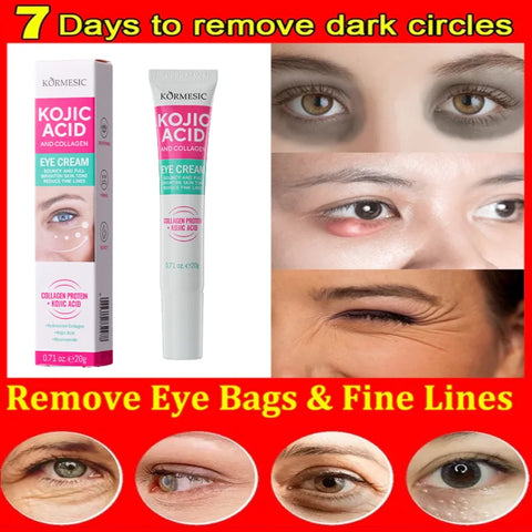 Collagen Eye Cream Remove Eyes Bags Anti Dark Circles Puffiness
