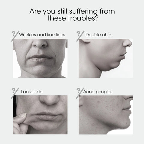 Multifunctional Face Lifting Instrument - Facial Slimming Rejuvenation Microcurrent Massager for Skin Firming Beauty Care