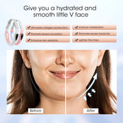 Multifunctional Face Lifting Instrument - Facial Slimming Rejuvenation Microcurrent Massager for Skin Firming Beauty Care