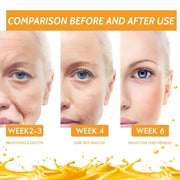 Vitamin C Essence remove Wrinkle Firming Fade Fine Lines